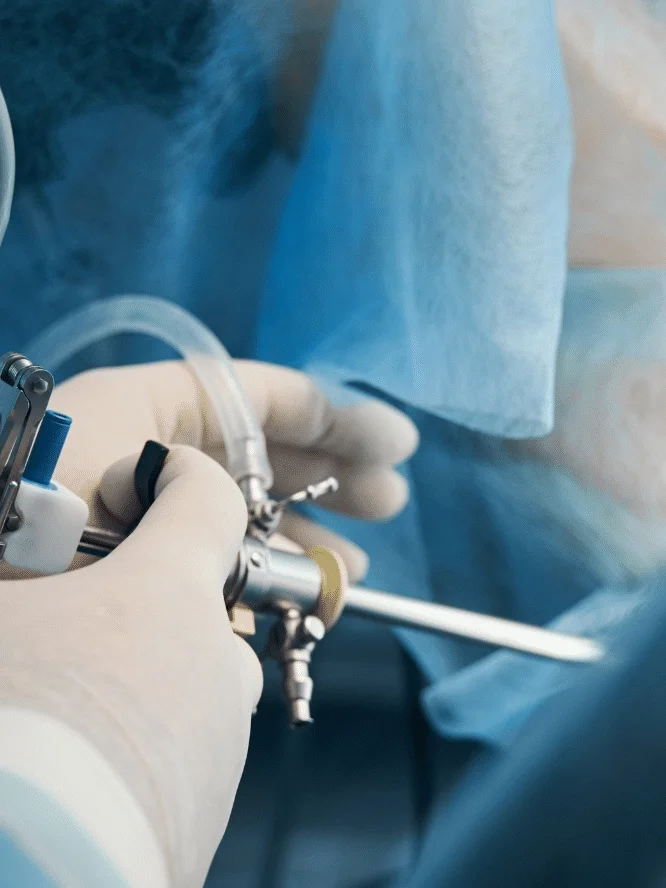 Laparoscopic Surgery