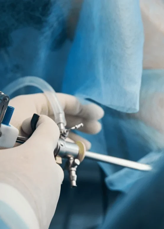 Laparoscopic Surgery